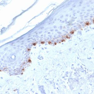 Formalin-fixed, paraffin-embedded human Skin stained with TYRP1-Monospecific Mouse Monoclonal Antibody (TYRP1/1986).