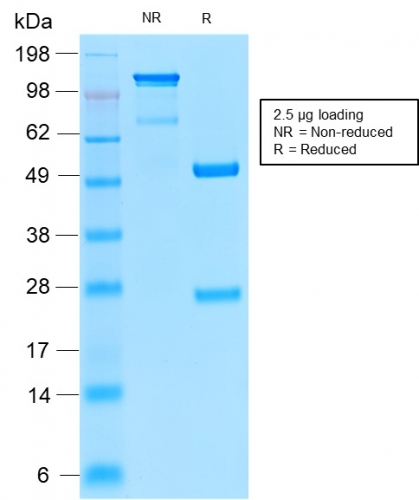 SDS-PAGE Analysis Purified TYRP1 Recombinant Rabbit Monoclonal Antibody (TYRP1/2340R). Confirmation of Purity and Integrity of Antibody.