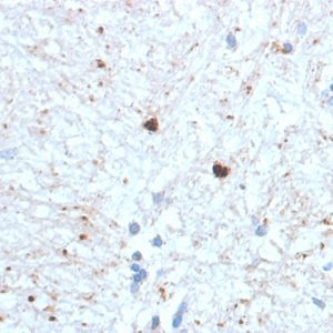 Formalin-fixed, paraffin-embedded human Brain stained with Ubiquitin-Monospecific Mouse Monoclonal Antibody (UBB/1748).