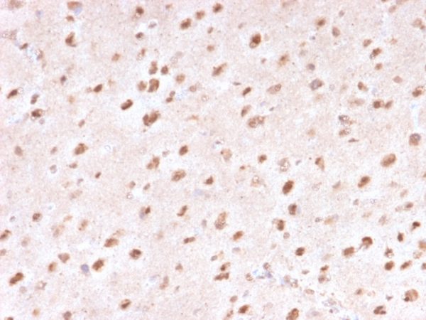 Formalin-fixed, paraffin-embedded human Brain stained with Ubiquitin-Monospecific Mouse Monoclonal Antibody (UBB/1748).