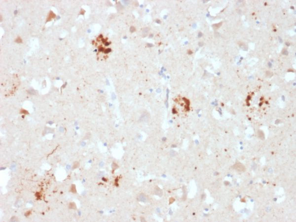 Formalin-fixed, paraffin-embedded human Brain stained with Ubiquitin Mouse Monoclonal Antibody (UBB/2122).