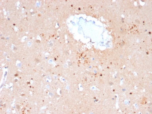 Formalin-fixed, paraffin-embedded human Brain stained with Ubiquitin Mouse Monoclonal Antibody (UBB/2122).