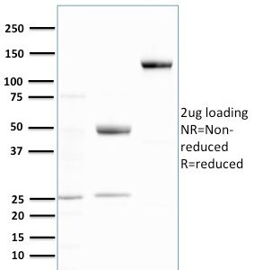 SDS-PAGE Analysis Purified Ubiquitin Recombinant Rabbit Monoclonal Antibody (UBB/3143R). Confirmation of Purity and Integrity of Antibody.