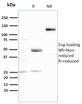 SDS-PAGE Analysis Purified Ubiquitin Recombinant Rabbit Monoclonal Antibody (UBB/3143R). Confirmation of Purity and Integrity of Antibody.