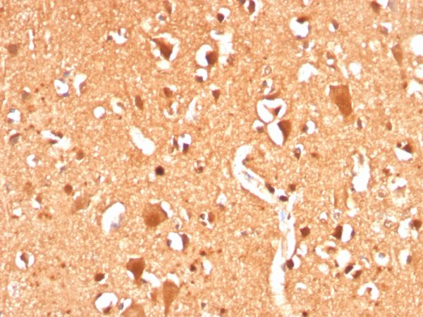 Formalin-fixed, paraffin-embedded human Brain stained with Ubiquitin Recombinant Rabbit Monoclonal Antibody (UBB/3143R).