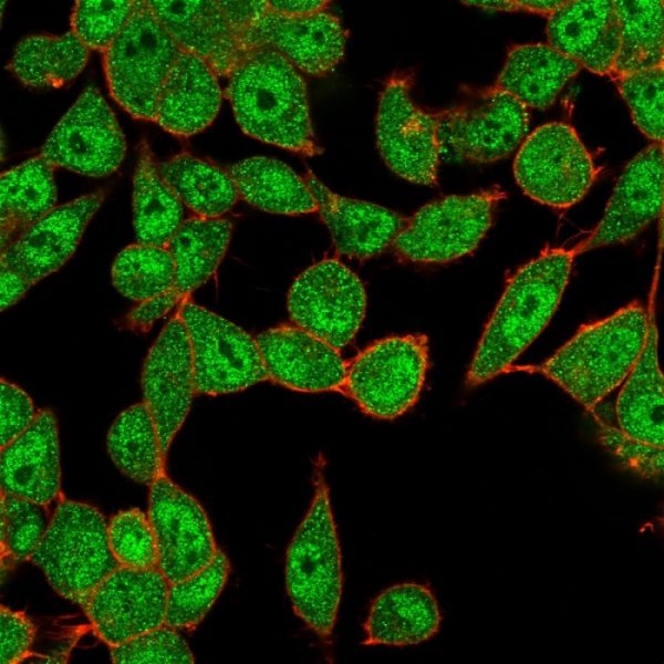 Immunofluorescent Analysis of PFA-fixed HeLa cells. UBE2B Mouse Monoclonal Antibody (PCRP-UBE2B-1C7) followed by IgG-CF488 (green), counterstained with phalloidin.