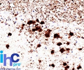 Formalin-fixed, paraffin-embedded human brain stained with Pgp9.5 / UchL1 Mouse Monoclonal Antibody (31A3).