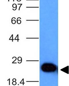 PGP9.5 / UchL1 (pan-Neuronal Marker) Antibody