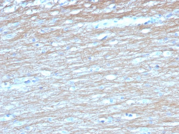 Formalin-fixed, paraffin-embedded human cerebellum stained with Pgp9.5 Mouse Monoclonal Antibody (UCHL1/4558).
