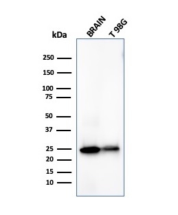 Western Blot Analysis of human Brain tissue and T98G cell lysates using Pgp9.5 Mouse Monoclonal Antibody (UCHL1/4558).