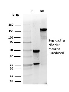 SDS-PAGE Analysis. Purified RPA2 Mouse Monoclonal Antibody (RPA2/4774). Confirmation of Purity and Integrity of Antibody.