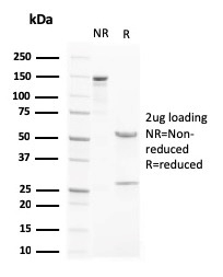 SDS-PAGE Analysis of Purified LX Receptor beta Mouse Monoclonal Antibody (LXRB/2731). Confirmation of Purity and Integrity of Antibody.