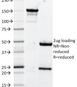 SDS-PAGE Analysis of Purified CD106 Monoclonal Antibody (1.4C3). Confirmation of Purity and Integrity of Antibody.
