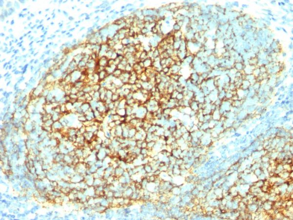 Formalin-fixed, paraffin-embedded human Tonsil stained with CD106 Monoclonal Antibody (1.4C3).