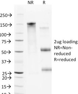 SDS-PAGE Analysis of Purified CD106 Mouse Monoclonal antibody (B-K9). Confirmation of Purity and Integrity of Antibody.