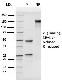 SDS-PAGE Analysis of Purified CD106 Mouse Monoclonal antibody (VCAM1/3499). Confirmation of Purity and Integrity of Antibody.