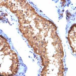 Formalin-fixed, paraffin-embedded human Testis stained with VCL Mouse Monoclonal Antibody (VCL/2572).