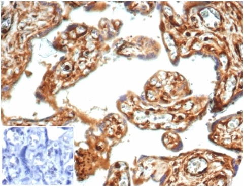 Formalin-fixed, paraffin-embedded human placentastained with Vinculin Recombinant Rabbit Monoclonal Antibody (VCL/7091R) at 2ug/ml. Inset: PBS instead of primary antibody; secondary only negative control.