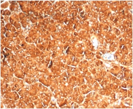 Formalin-fixed, paraffin-embedded human pancreasstained with Vinculin Recombinant Rabbit Monoclonal Antibody (VCL/7091R) at 2ug/ml.