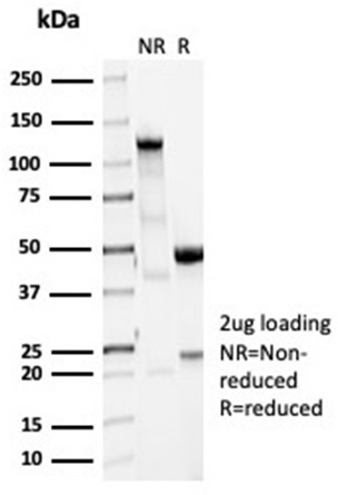 SDS-PAGE Analysis Purified Vinculin Recombinant Rabbit Monoclonal Antibody (VCL/7091R). Confirmation of Purity and Integrity of Antibody.