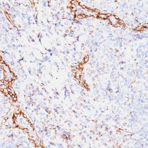Formalin-fixed, paraffin-embedded human tonsil stained with VEGF Mouse Monoclonal Antibody (VEGF/1063).