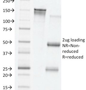 SDS-PAGE Analysis of Purified VEGF Mouse Monoclonal Antibody (VG76e). Confirmation of Integrity and Purity of Antibody.