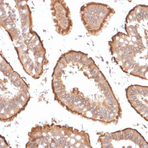 Formalin-fixed, paraffin-embedded human Small Intestine stained with Villin Mouse Monoclonal Antibody (VIL1/1314 + VIL1/2376).