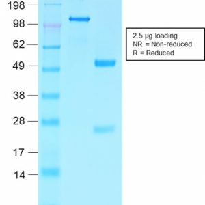 SDS-PAGE Analysis Purified Villin Rabbit Recombinant Monoclonal Antibody (VIL1/2310R). Confirmation of Integrity and Purity of the Antibody.