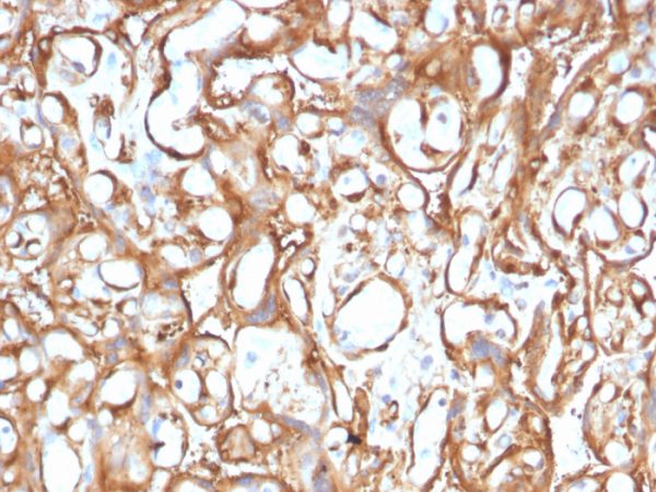 Formalin-fixed, paraffin-embedded human Placenta stained with Ezrin Mouse Monoclonal Antibody (CPTC-Ezrin-1).