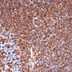 Formalin-fixed, paraffin-embedded human tonsil stained with Vimentin Recombinant Mouse Monoclonal Antibody (rVIM/6431).
