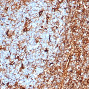 Formalin-fixed, paraffin-embedded human tonsil stained with Vimentin Recombinant Mouse Monoclonal Antibody (rVIM/6575).