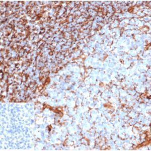 Formalin-fixed, paraffin-embedded human tonsil stained with Vimentin Mouse Recombinant Monoclonal Antibody (rVIM/6914). Inset: PBS instead of primary, secondary antibody control.