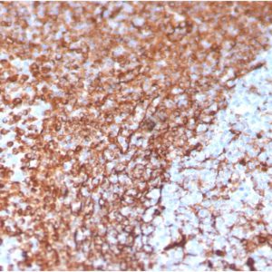 Formalin-fixed, paraffin-embedded human tonsil stained with Vimentin Mouse Monoclonal Antibody (VIM/3736).