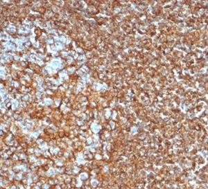Formalin-fixed, paraffin-embedded human tonsil stained with Vimentin Recombinant Rabbit Monoclonal Antibody (VIM/6430R).