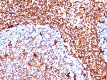 Formalin-fixed, paraffin-embedded human tonsil stained with Vimentin Recombinant Rabbit Monoclonal Antibody (VIM/6430R).