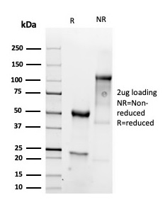 SDS-PAGE Analysis Purified Vimentin Recombinant Rabbit Monoclonal Antibody (VIM/6430R). Confirmation of Purity and Integrity of Antibody.