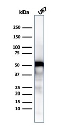 Western Blot Analysis of U87 cell lysate using Vimentin Recombinant Rabbit Monoclonal Antibody (VIM/6430R).