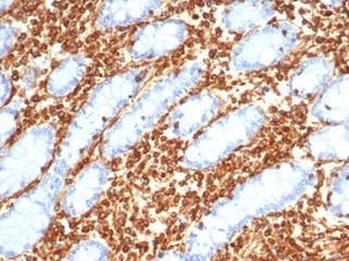 Formalin-fixed, paraffin-embedded equine (horse) small intestine stained with Vimentin Recombinant Rabbit Monoclonal Antibody (VIM/6430R).