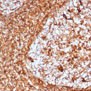 Formalin-fixed, paraffin-embedded human tonsil stained with Vimentin Recombinant Rabbit Monoclonal Antibody (VIM/6576R).