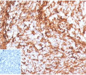 Formalin-fixed, paraffin-embedded human tonsil stained with Vimentin Rabbit Recombinant Monoclonal Antibody (VIM/4388R). Inset: PBS instead of primary, secondary antibody control.