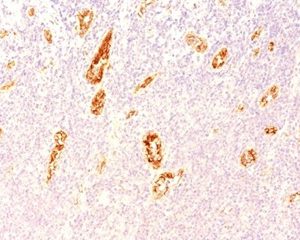 Formalin-fixed, paraffin-embedded human pancreas stained with vWF Mouse Monoclonal Antibody (3E2D10).