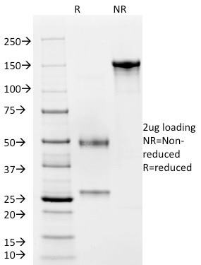 SDS-PAGE Analysis of Purified vWF Mouse Monoclonal Antibody (VWF/2480). Confirmation of Purity and Integrity of Antibody.