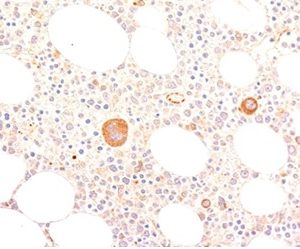 Formalin-fixed, paraffin-embedded human bone marrow stained with vWF Mouse Monoclonal Antibody (VWF635).