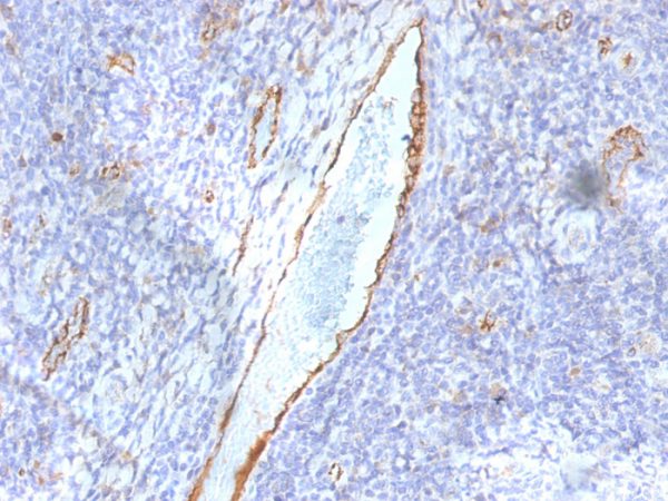 Formalin-fixed, paraffin-embedded human Tonsil stained with vWF Mouse Monoclonal Antibody (F8/86).
