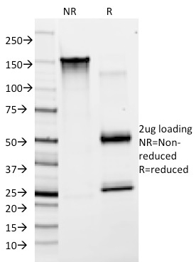SDS-PAGE Analysis of Purified vWF Mouse Monoclonal Antibody (F8/86). Confirmation of Purity and Integrity of Antibody.