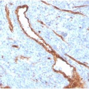 Formalin-fixed, paraffin-embedded human bone marrow stained with vWFRecombinant Rabbit Monoclonal Antibody (VWF/4384R).