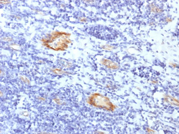 Formalin-fixed, paraffin-embedded human Tonsil stained with vWF Rabbit Recombinant Monoclonal Antibody (VWF/1859R).