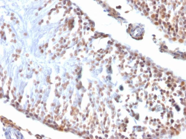 Formalin-fixed, paraffin-embedded Rat Testis stained with Wilm&apos;s Tumor Mouse Monoclonal Antibody (6F-H2).