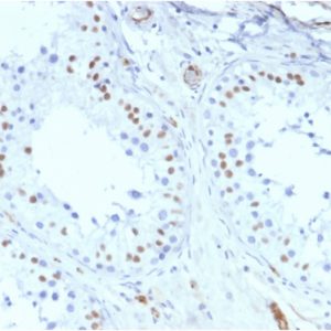 Formalin-fixed, paraffin-embedded human Testis stained with Wilm&apos;s Tumor Mouse Recombinant Monoclonal Antibody (rWT1/857).