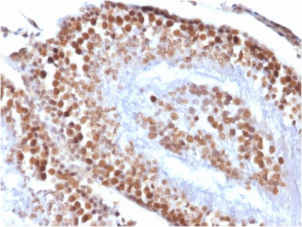 Formalin-fixed, paraffin-embedded Rat Testis stained with Wilm&apos;s Tumor Mouse Recombinant Monoclonal Antibody (rWT1/857).